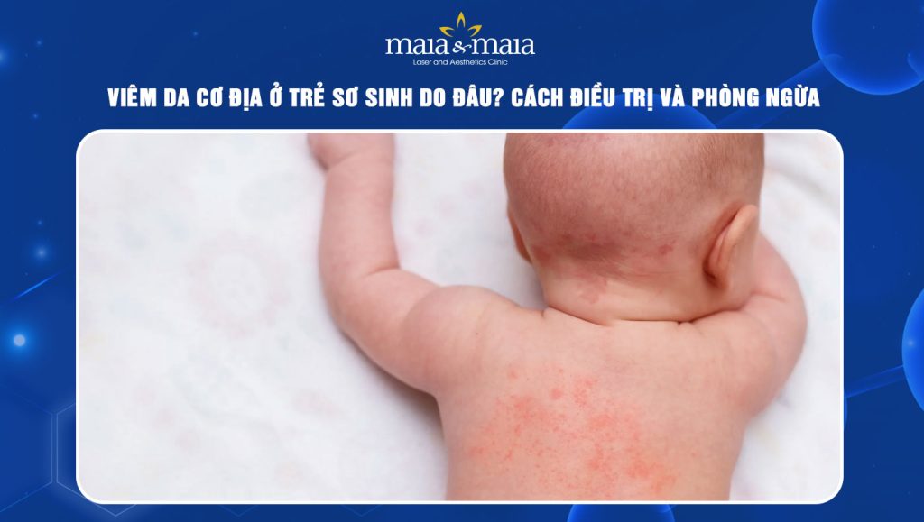 Viêm da cơ địa ở trẻ sơ sinh