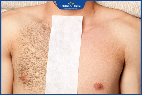 wax lông ngực