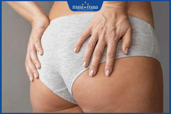 ảnh hưởng da mông sần sùi