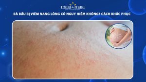 bà bầu bị viêm nang lông