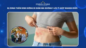 bị zona thần kinh kiêng đi đám ma