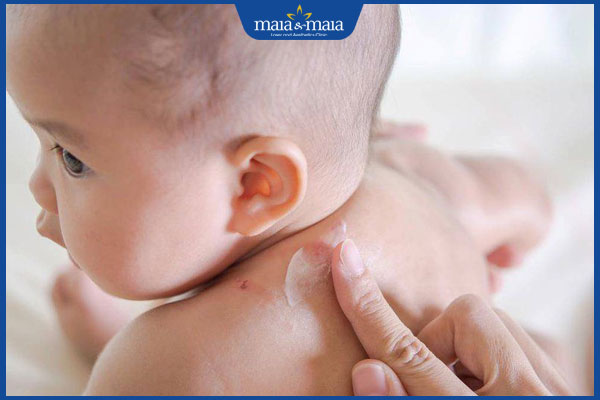 bôi thuốc cho trẻ