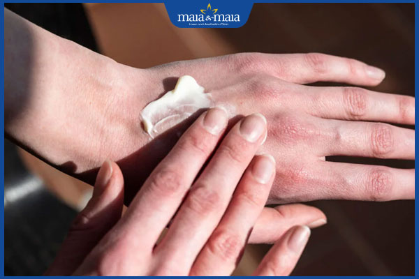 Viêm da dị ứng ở mặt có nguy hiểm không? Cách điều trị 8 bôi thuốc trị dị ứng đúng cách