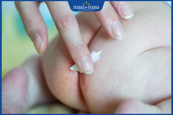 bôi thuốc trị viêm da tã lót