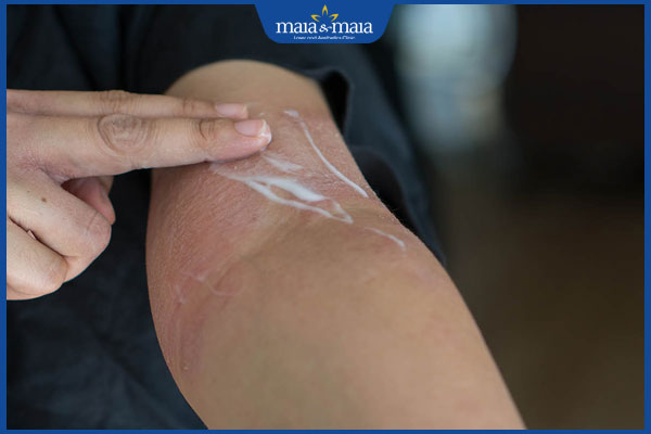 bôi thuốc trị viêm da