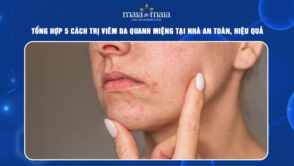 Tổng hợp 5 cách trị viêm da quanh miệng tại nhà an toàn 1 cách trị viêm da quanh miệng tại nhà