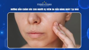 chăm sóc cho người bị viêm da dầu