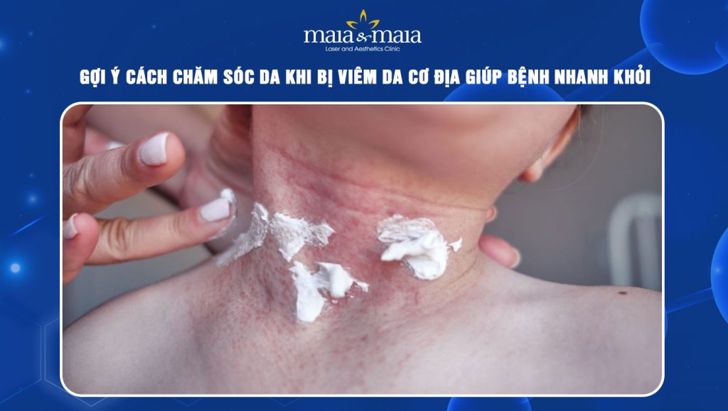 chăm sóc da khi bị viêm da cơ địa