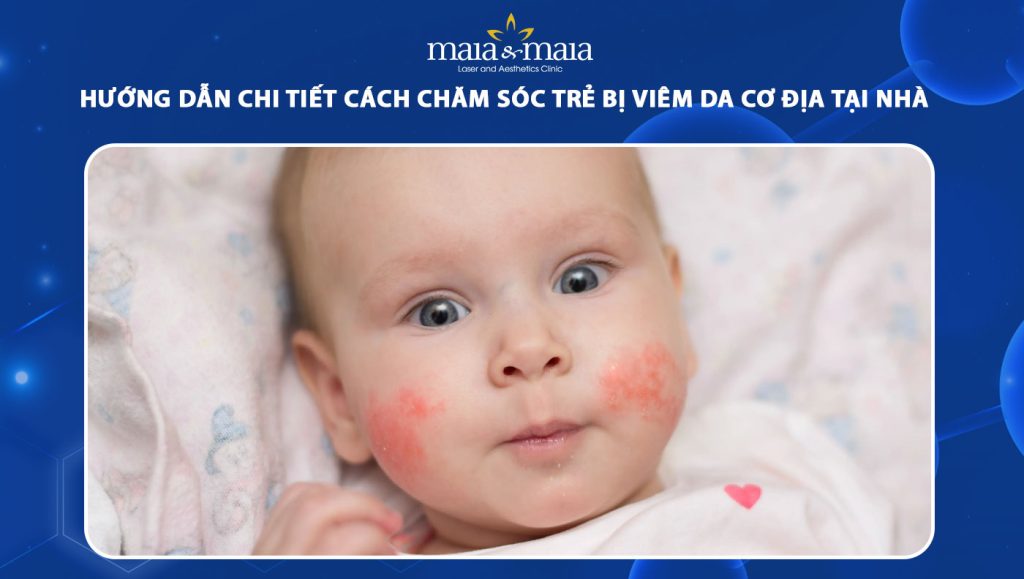 Chi tiết cách chăm sóc trẻ bị viêm da cơ địa tại nhà 1 chăm sóc trẻ bị viêm da cơ địa