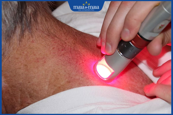 chiếu laser trị zona thần kinh