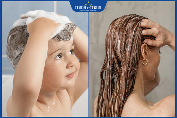 Top 6 dầu gội trị viêm da tiết bã hiệu quả, an toàn cho da 3 chọn dầu gội phù hợp