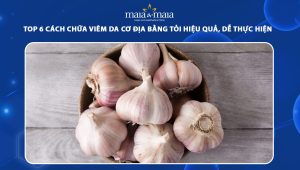 chữa viêm da cơ địa bằng tỏi