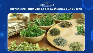 chữa viêm da tiết bã bằng dân gian