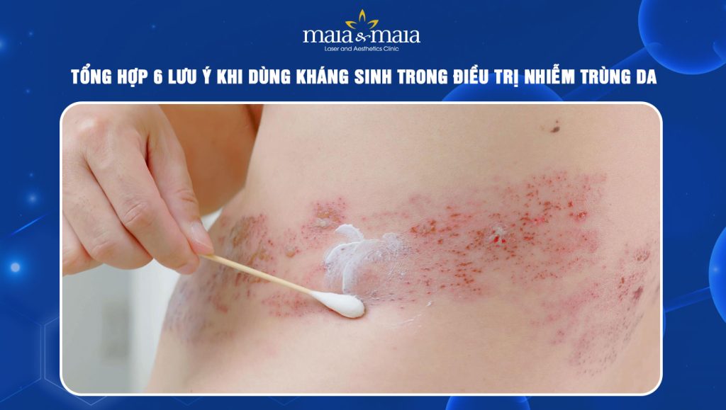 6 lưu ý khi dùng kháng sinh trong điều trị nhiễm trùng da 1 dùng kháng sinh trong điều trị nhiễm trùng da