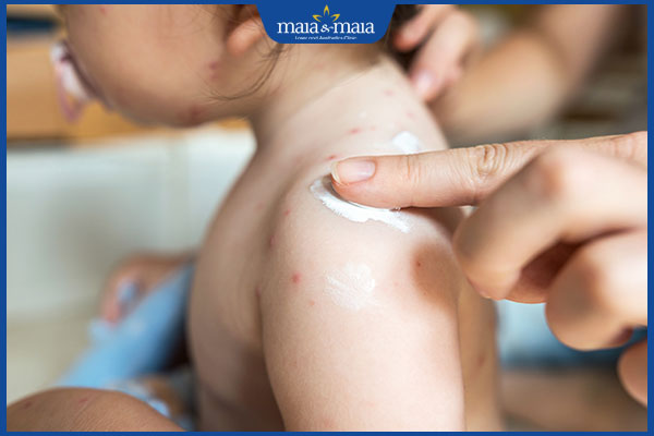 dưỡng ẩm cho trẻ