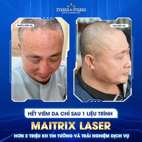 khách chữa viêm da