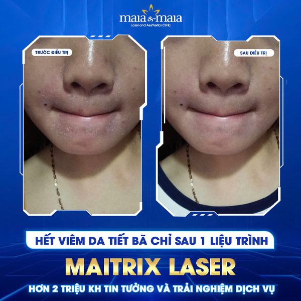 khách hàng chữa viêm da cơ địa thành công