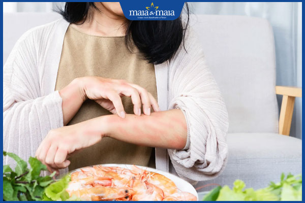 kiêng ăn hải sản