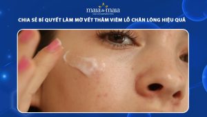làm mờ vết thâm viêm lỗ chân lông