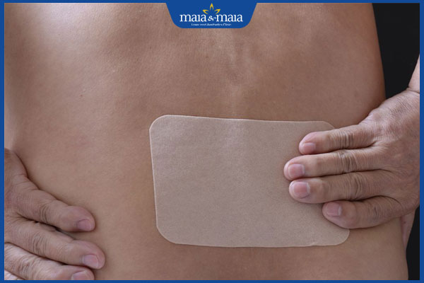 miếng dán giảm đau sau zona