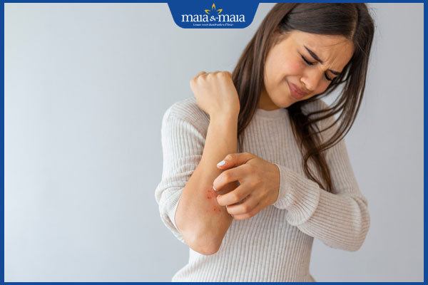 ngứa khi bị viêm da cơ địa