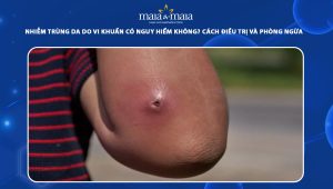 nhiễm trùng da do vi khuẩn