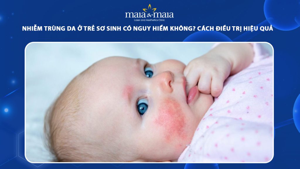 Nhiễm trùng da ở trẻ sơ sinh: Nguyên nhân và cách điều trị 1 nhiễm trùng da ở trẻ sơ sinh