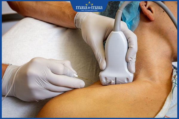 phong bế thần kinh