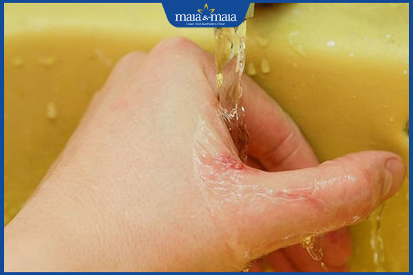 rửa vết thương