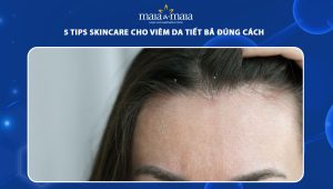 skincare cho viêm da tiết bã