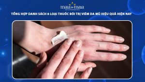thuốc bôi trị viêm da mủ