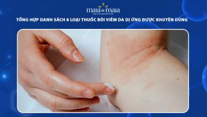 thuốc bôi viêm da dị ứng