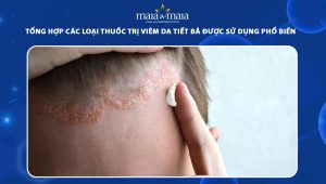 thuốc trị viêm da tiết bã