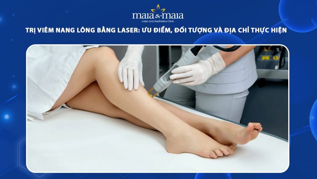 trị viêm nang lông bằng laser