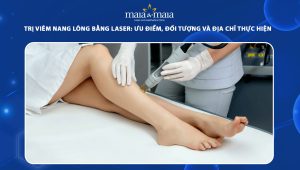 trị viêm nang lông bằng laser