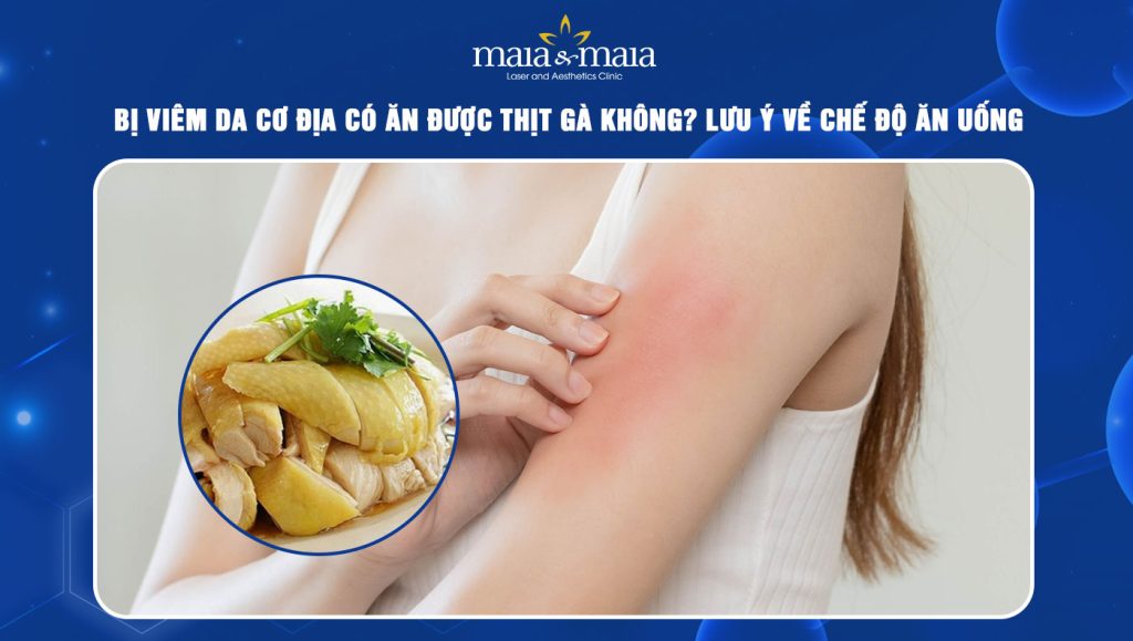Viêm da cơ địa có ăn được thịt gà không? Lưu ý chế độ ăn 1 viêm da cơ địa có ăn được thịt gà không