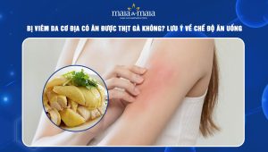 viêm da cơ địa có ăn được thịt gà không