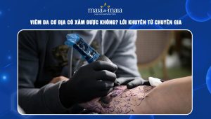 viêm da cơ địa có xăm được không