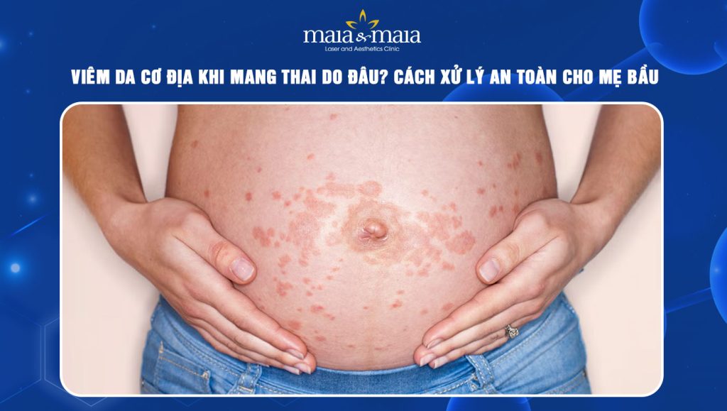 Viêm da cơ địa khi mang thai