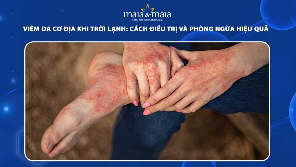 viêm da cơ địa khi trời lạnh
