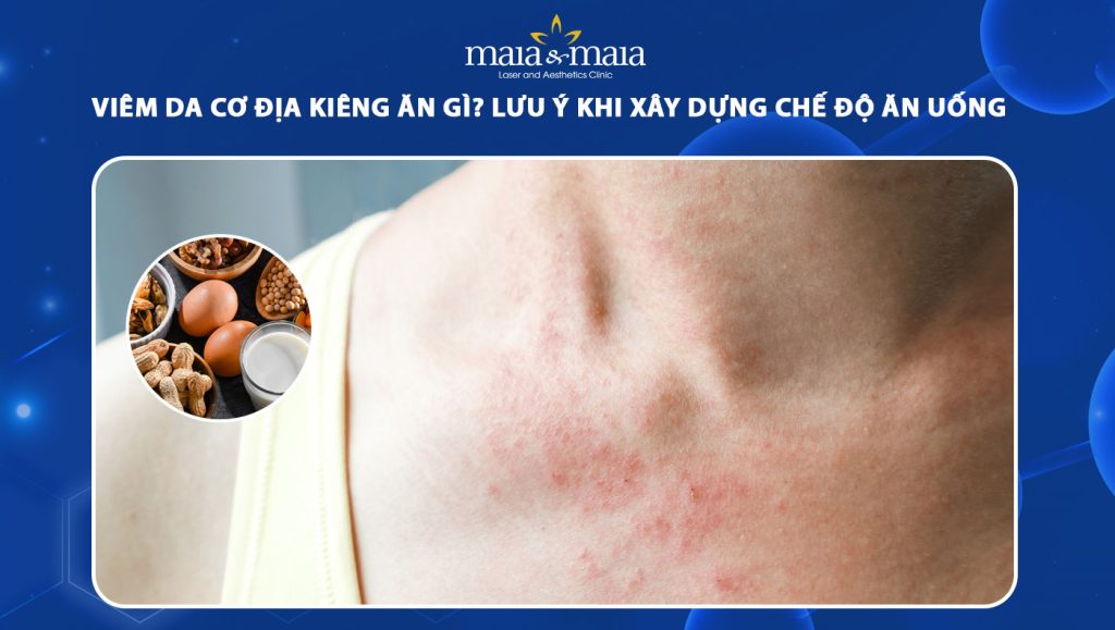 viêm da cơ địa kiêng ăn gì