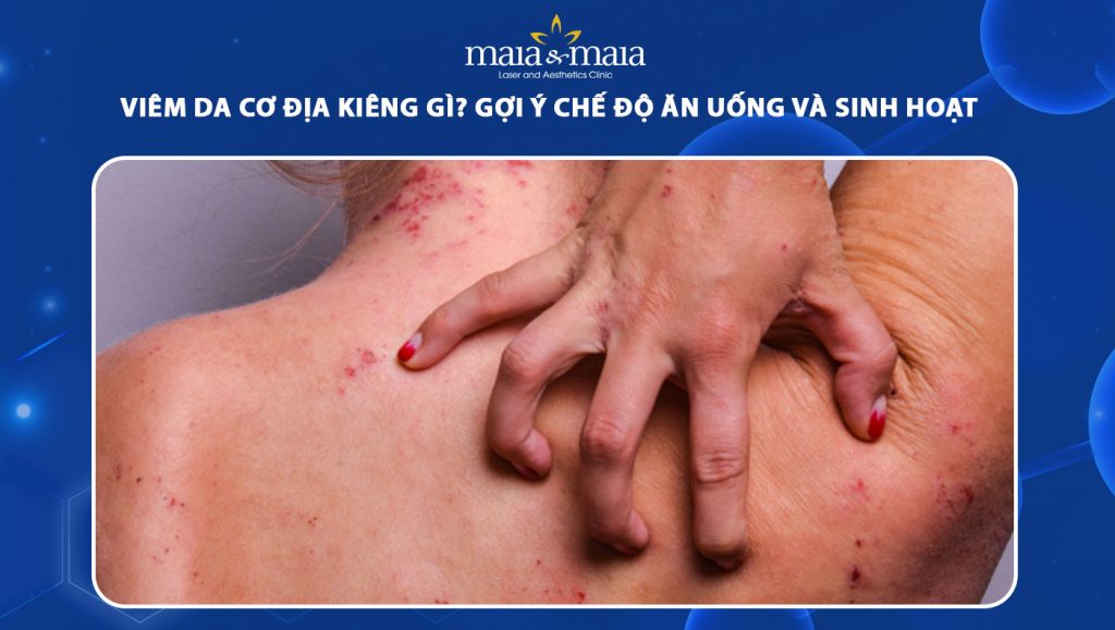 viêm da cơ địa kiêng gì