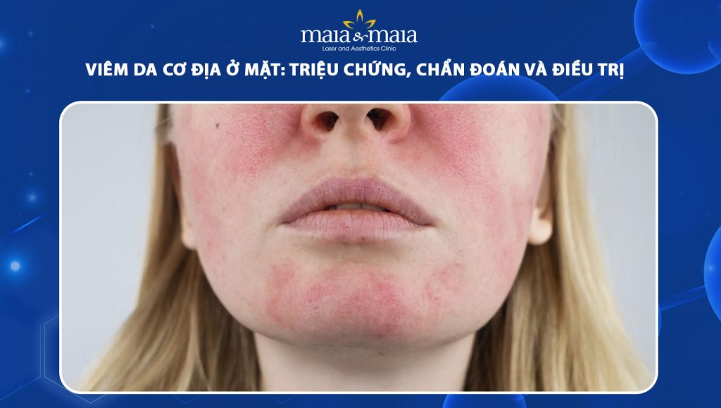 viêm da cơ địa ở mặt