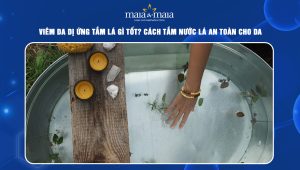 viêm da dị ứng tắm lá gì