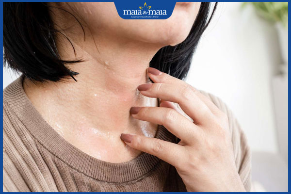 viêm da do thời tiết