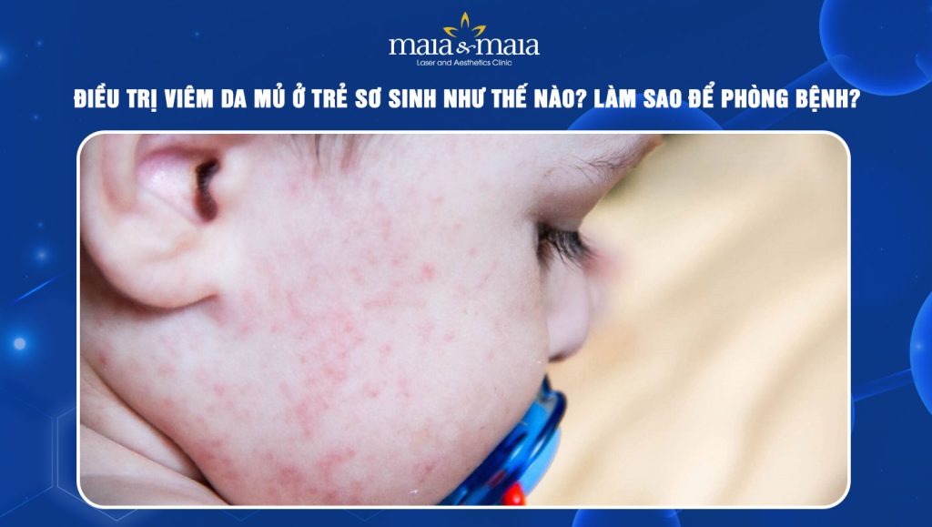 Viêm da mủ ở trẻ sơ sinh