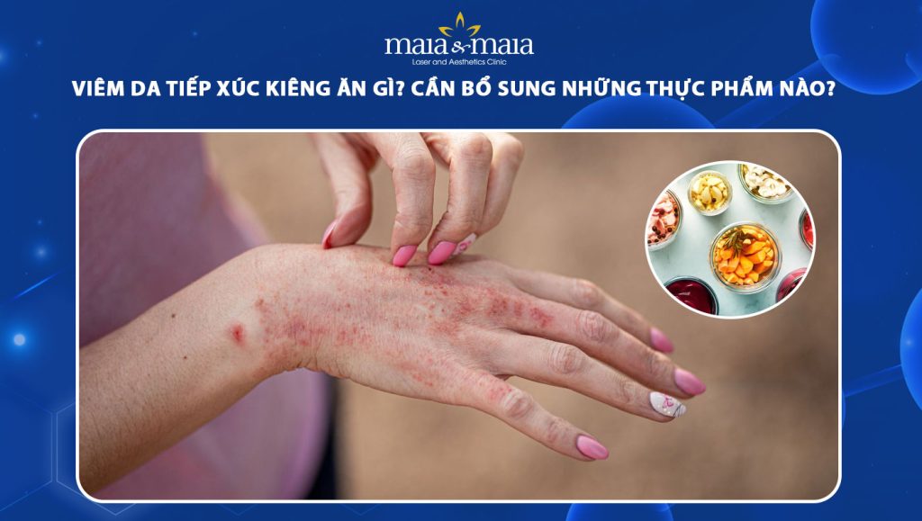 viêm da tiếp xúc kiêng ăn gì