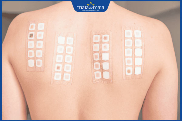 xét nghiệm áp bì