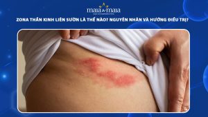 zona thần kinh liên sườn