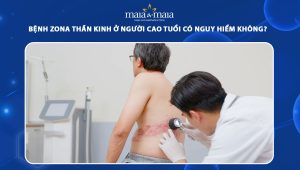 zona thần kinh ở người cao tuổi
